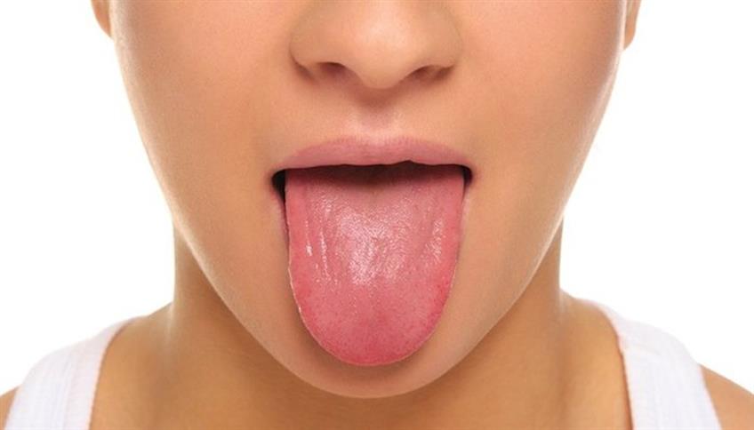 Tira fuori la lingua e il medico dirà come stai! Tira fuori la lingua e il medico dirà come stai!